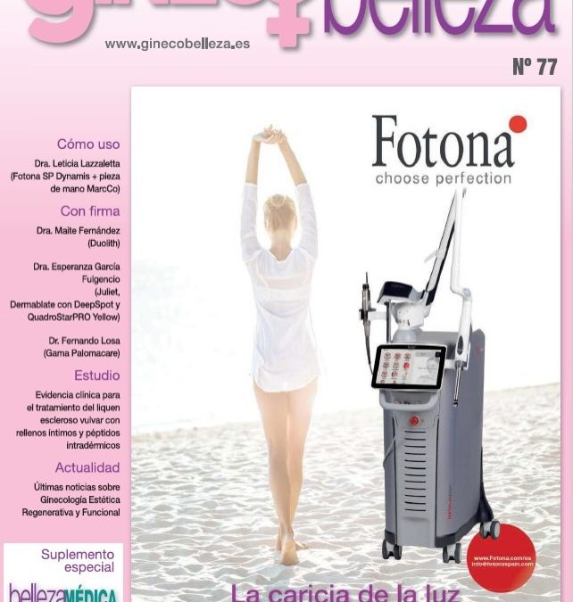 fotobiomodulación ginecológica mediante láser Fotona